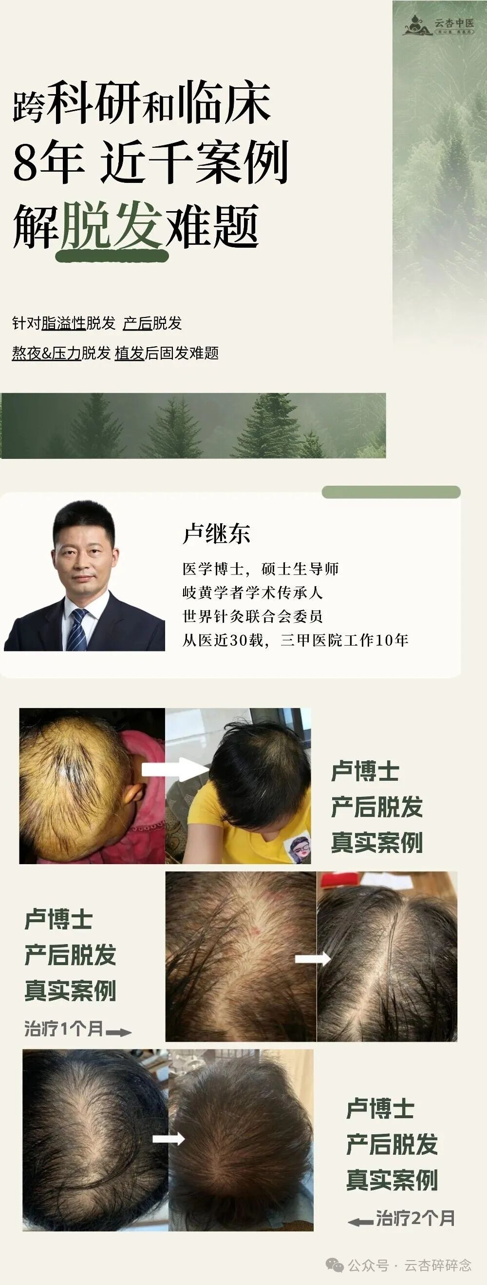 跨科研和临床,8年近千案例解脱发难题