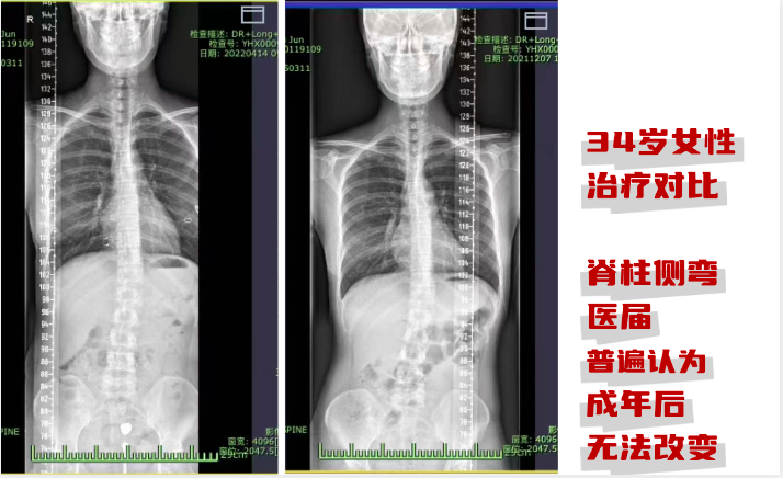 治疗前后对比